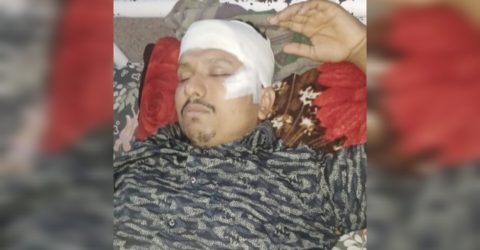 সাতকানিয়ায় সাবেক ইউপি মেম্বার মোরশেদ উপর সন্ত্রাসী হামলা 